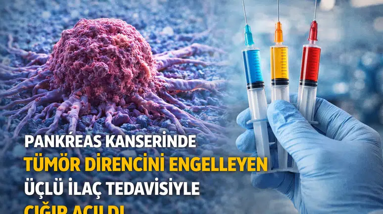 Pankreas Kanserinde Tümör Direncini Engelleyen Üçlü İlaç Tedavisiyle Çığır Açıldı